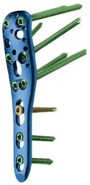 Medical fiberglass splint by Zhengzhou Maishijie Medical Instrument Co., Ltd.