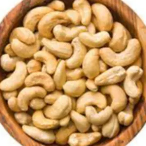 Cashew Nuts by Soxa Multiservice Resource Ltd