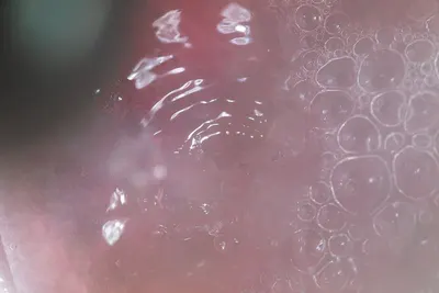 Sonography jelly by J K ENTERPRISE