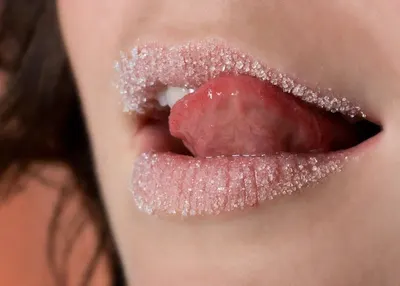 Sugar