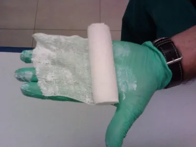 Orthopedic Casting Bandage by G3 Team