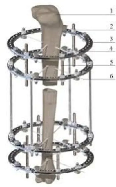 Turnstile Mechanism