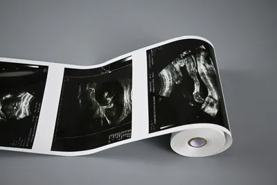 X-ray film viewer