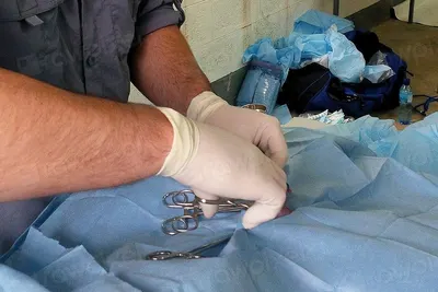 Umbilical Cord Clamps