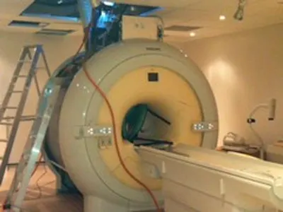 I-131 Radiotherapy