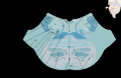 Posterior spinal system