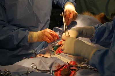 Surgical Gloves