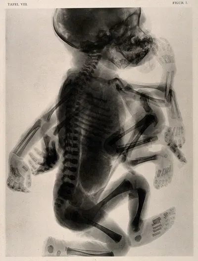 Xray film
