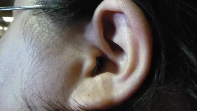 Ear plug