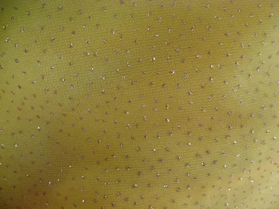 Star Insect Screen by Hitesh Metal